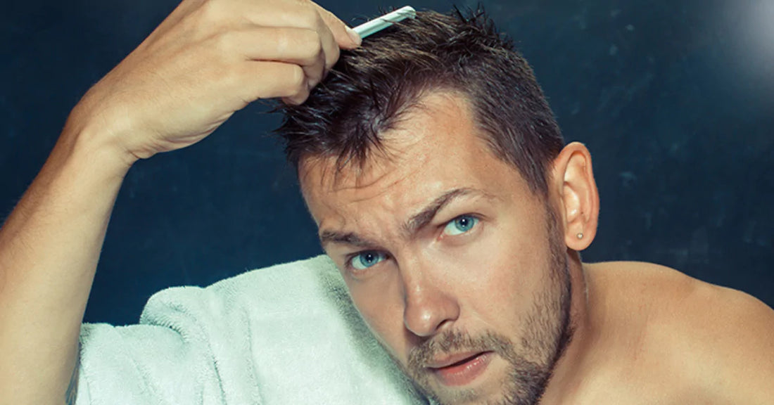 Hair loss in bodybuilding